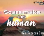 Scars Make Us Human